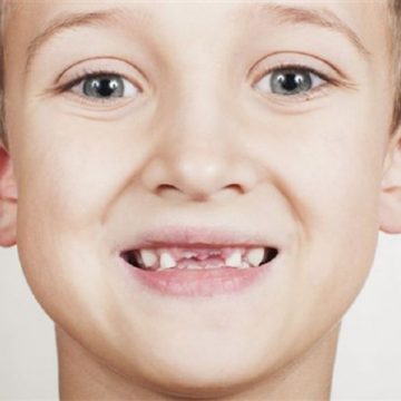 How Sugar Affects Child’s Teeth and What You Can Do About It?