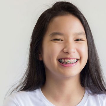 How ClearCorrect Braces Can Save Your Life