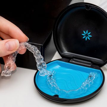 Overbite Problems? Invisalign Can Give You an Effective Solution